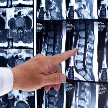 rheumatology-and-osteoporosis-image