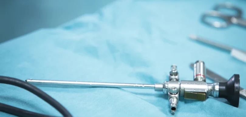 top-benefits-of-arthroscopy-surgery-blog