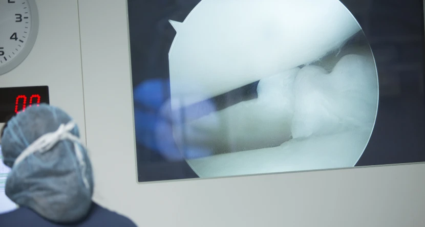 understanding-arthroscopy-blog-1