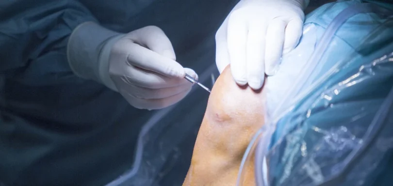 understanding-arthroscopy-blog