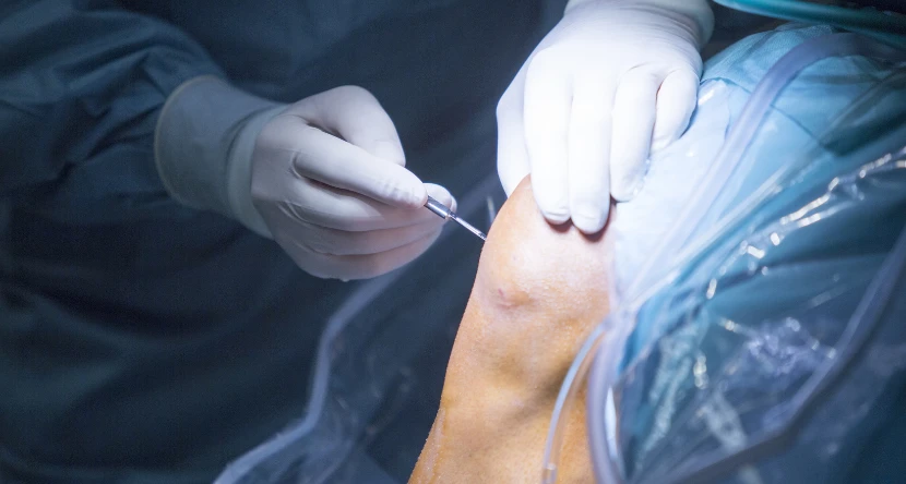 understanding-arthroscopy-blog