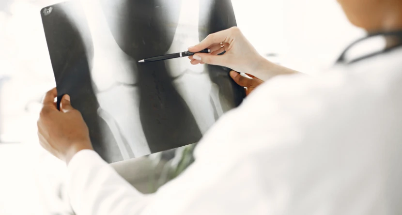 understanding-bone -and-joint-care-children-1